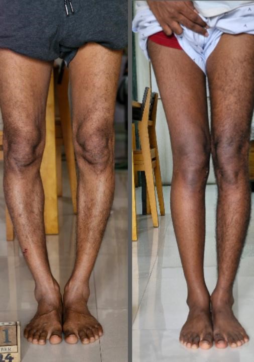 Treatment Image