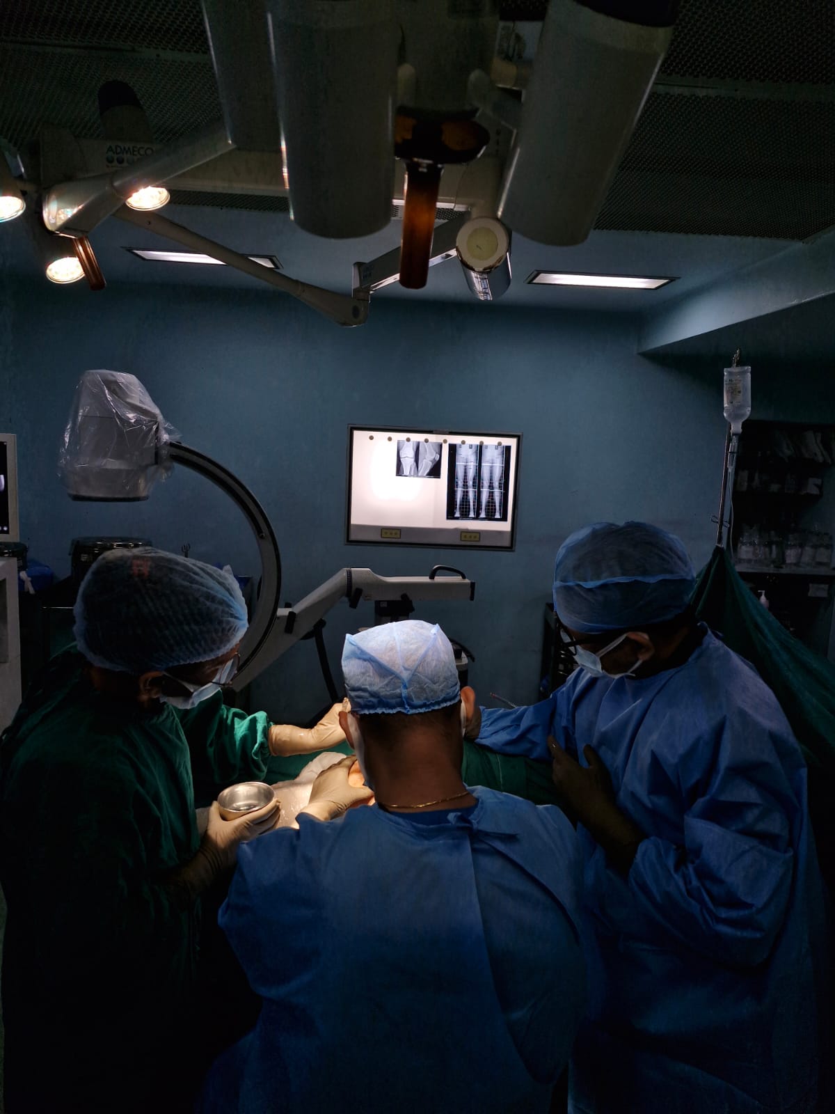 Treatment Image