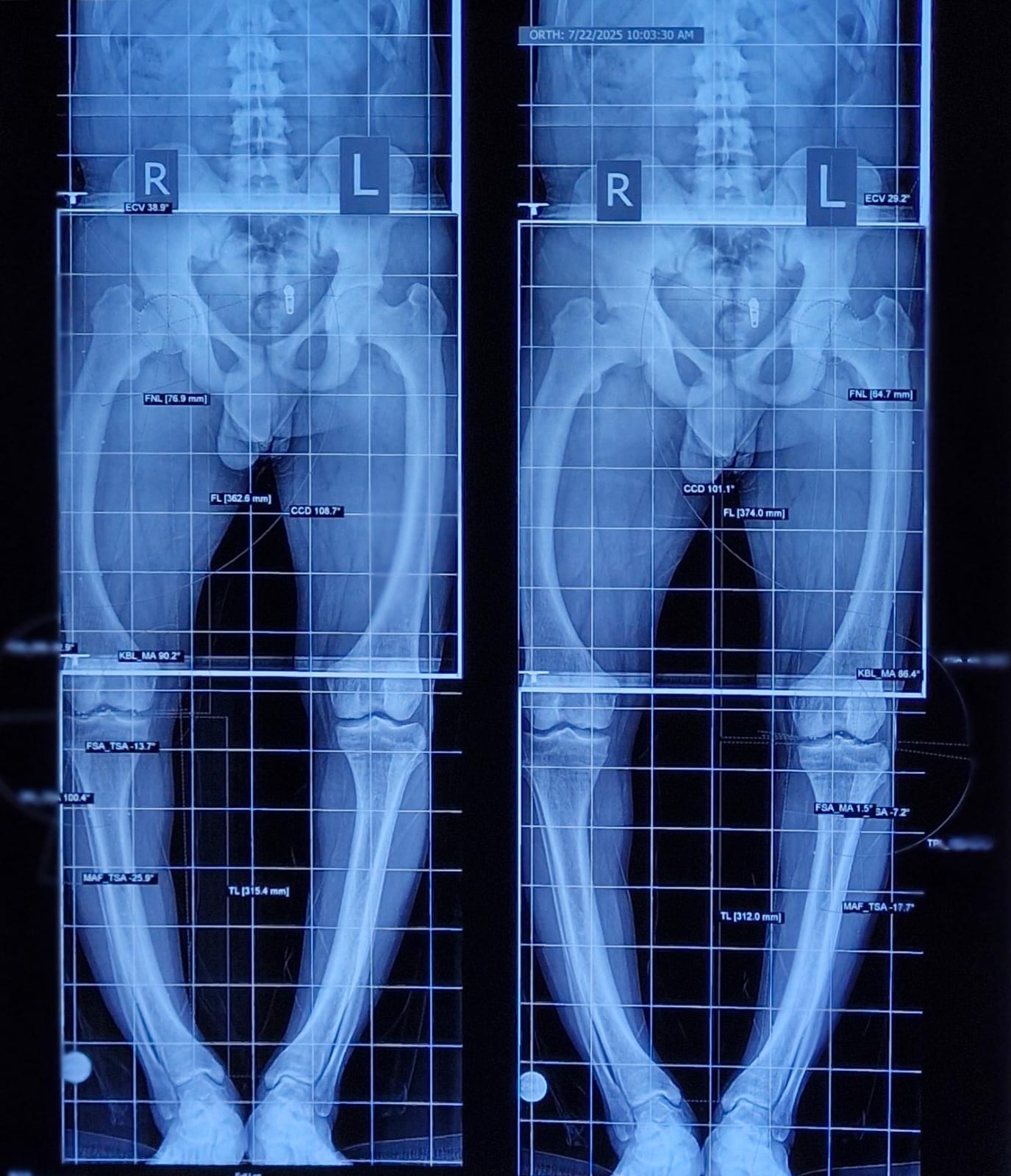 Treatment Image
