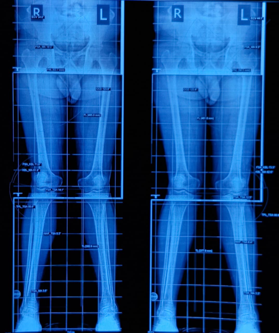 Treatment Image